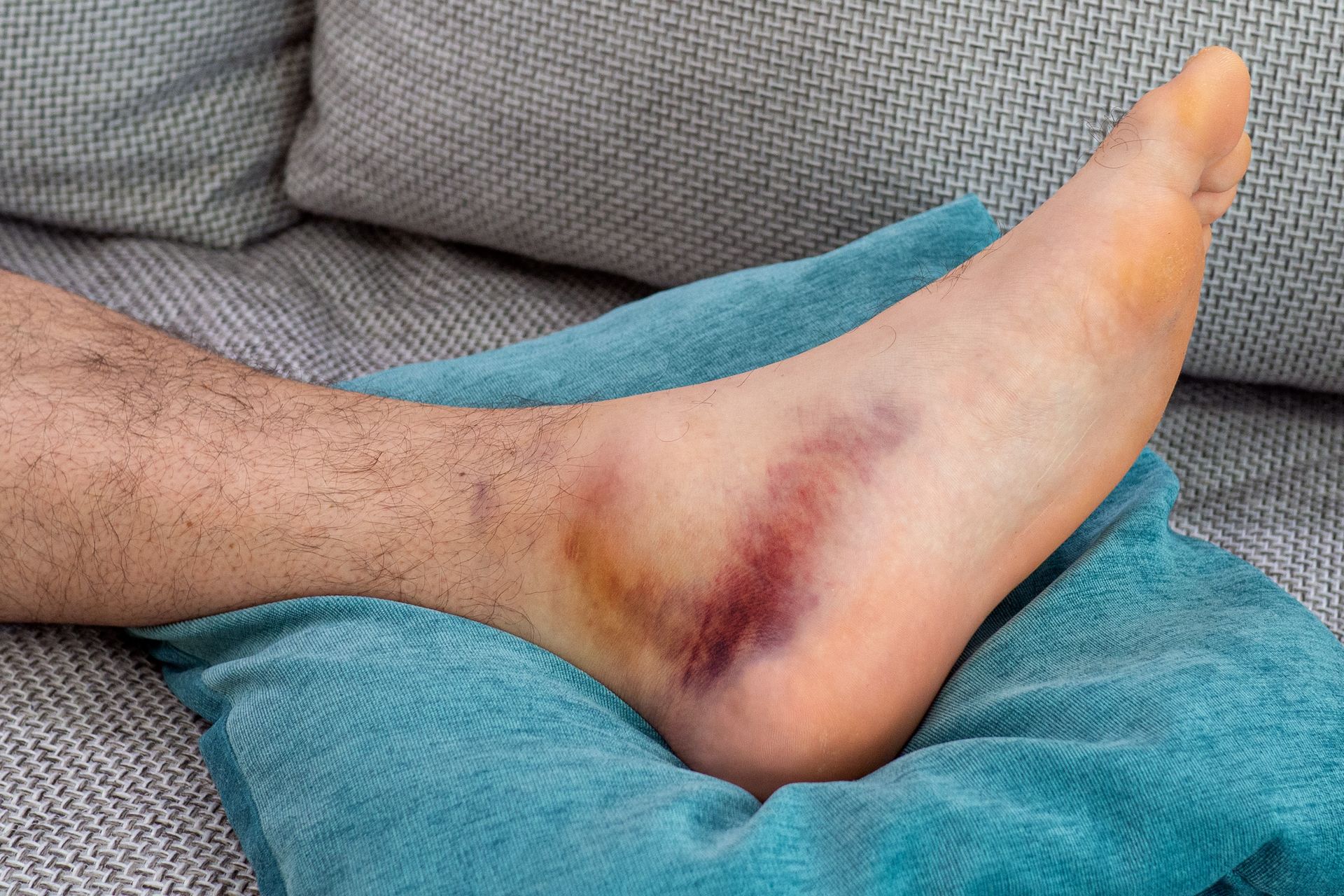 Ankle Instability