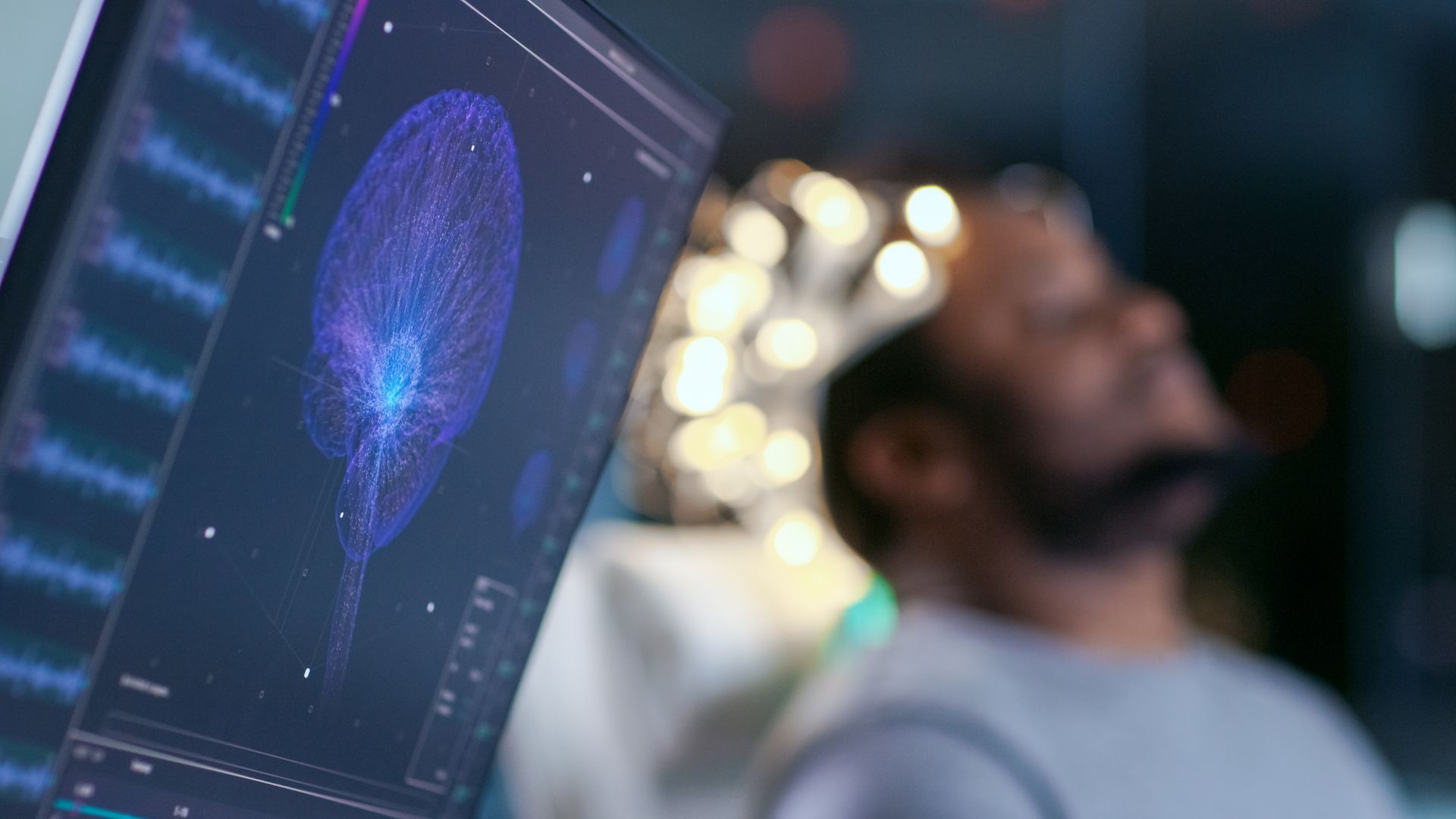 Computer monitor showing a brain scan.