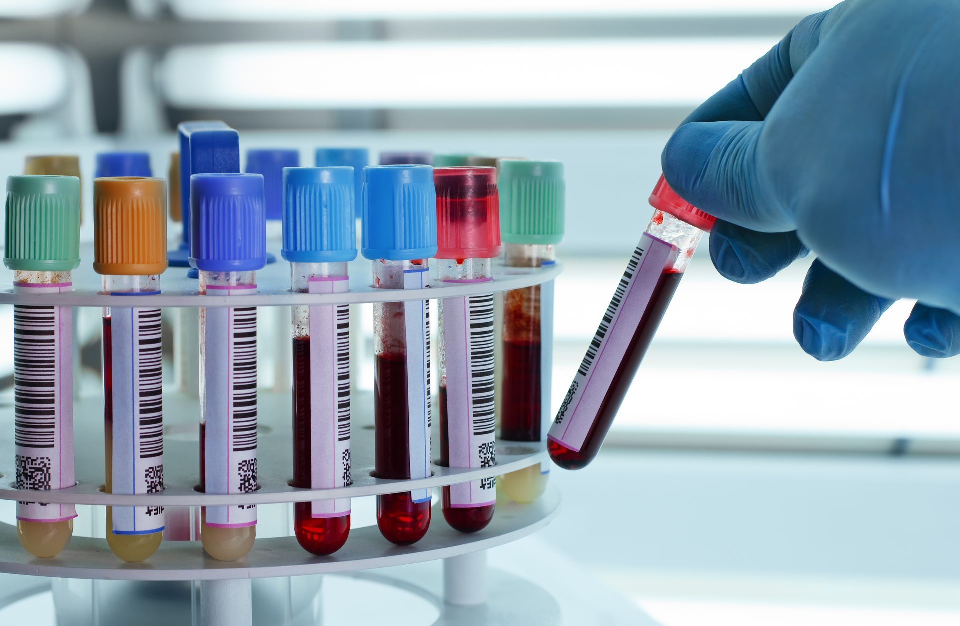 Gloved hand holding blood sample tube; other tubes filled with blood in a rack, laboratory setting.