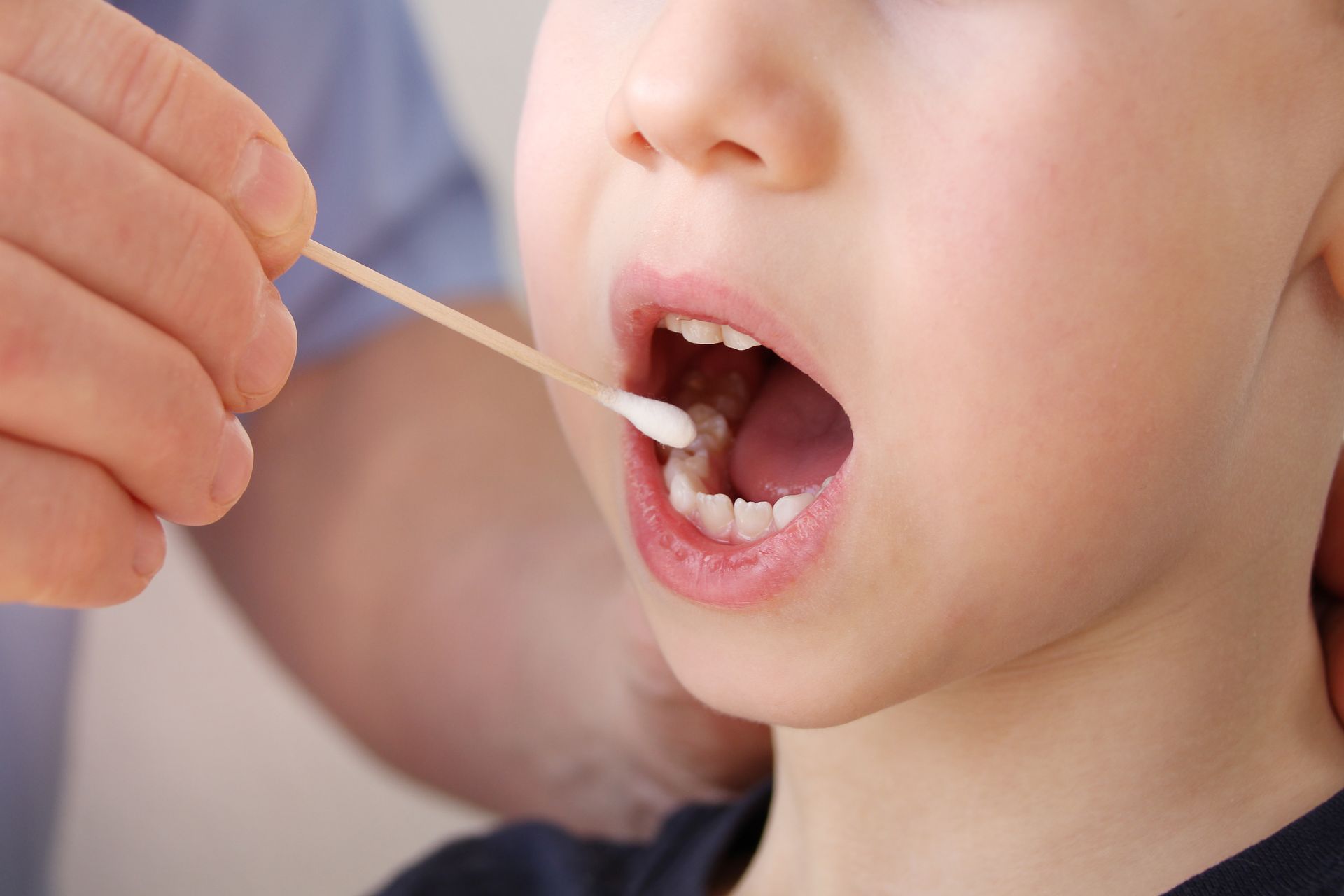Person's hand using a swab to collect a sample from a child's open mouth during a medical procedure.