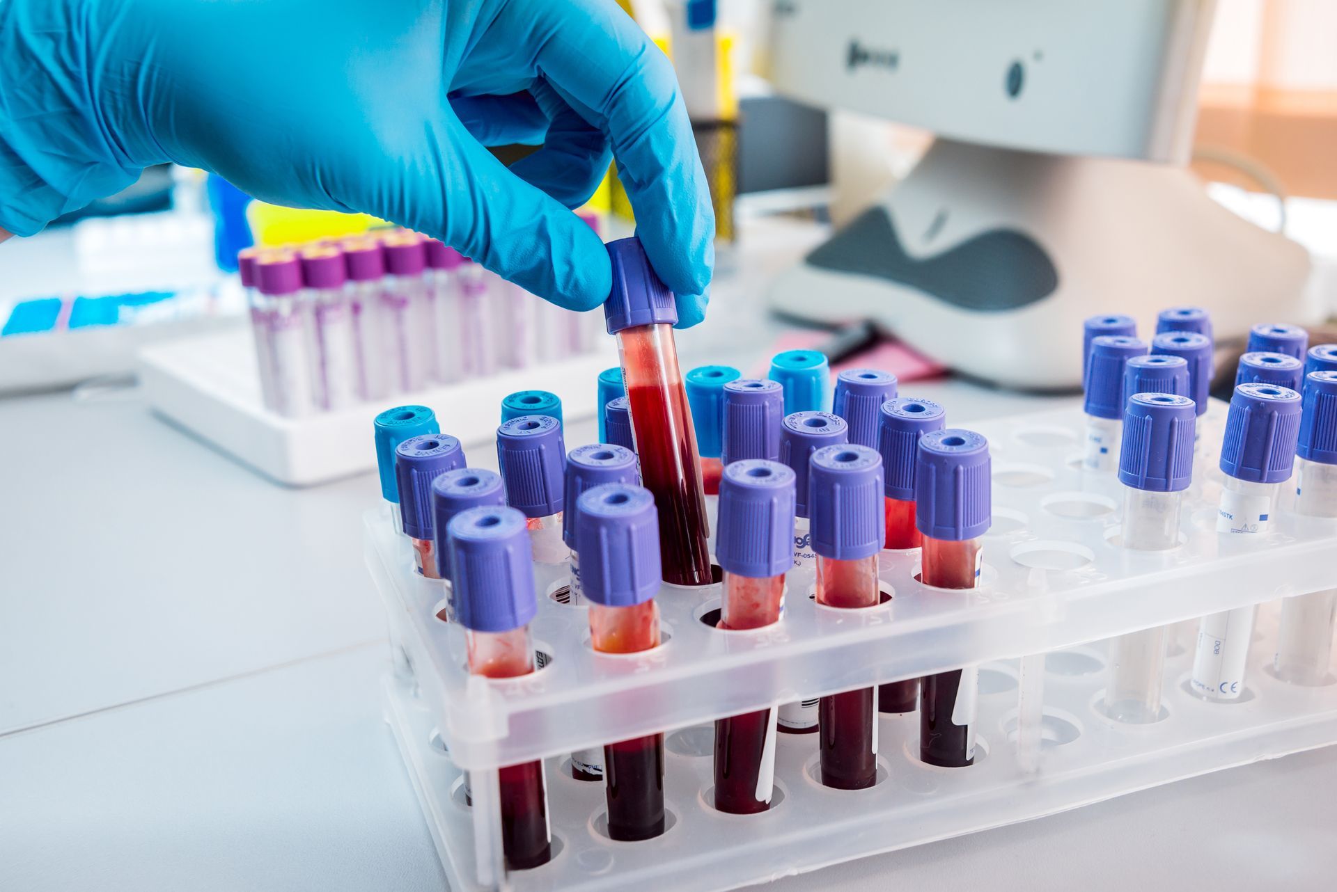 Hand in blue glove placing blood vial in a rack with other vials, lab setting.