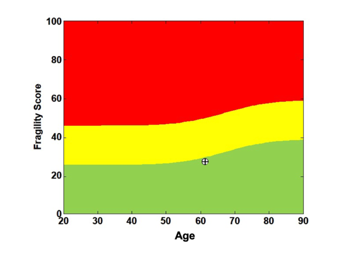 A graph showing the fragility score of a person by age