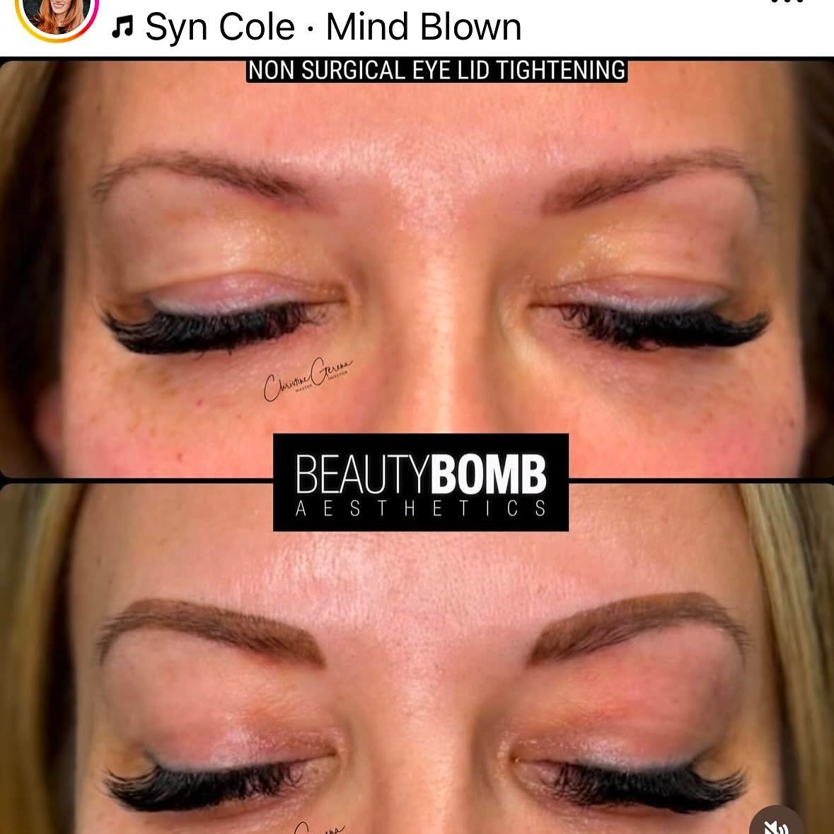 A before and after photo of a woman 's eyebrows and eyelashes. 