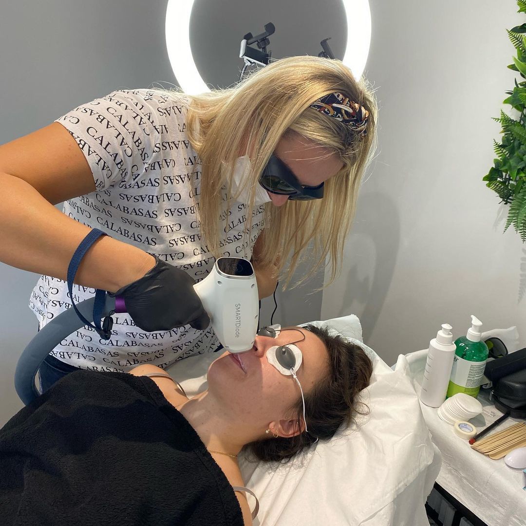 SMARTDiode laser hair removal