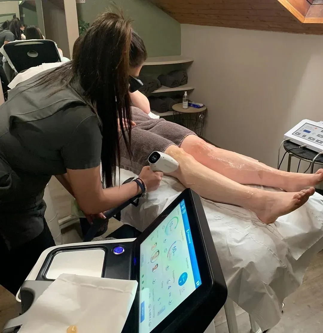 SMARTDiode laser hair removal