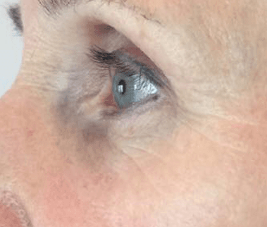 A close up of a woman 's eye with a blue pupil.