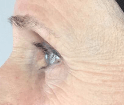 A close up of a woman 's eye with wrinkles.