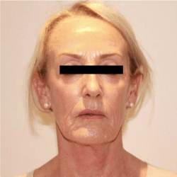 A close up of a woman 's face with a black line covering her eyes.
