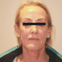 A close up of a woman 's face with a black line covering her eyes.