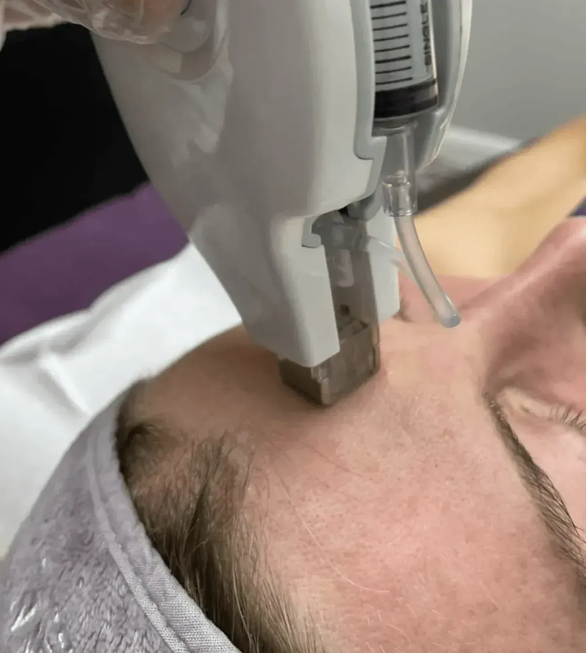 Innovative, Needle-Free Mesotherapy for Skin and Hair