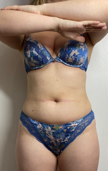 A woman in blue underwear is standing with her arms crossed.