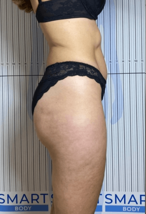 A woman in black underwear is standing in front of a smart body sign.