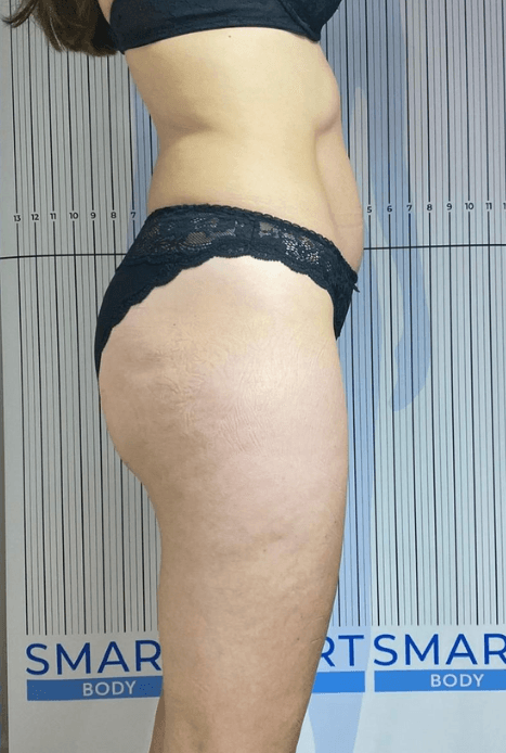 A woman in black underwear is standing in front of a sign that says smar body