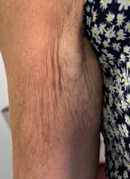 A close up of a woman 's arm with wrinkles.