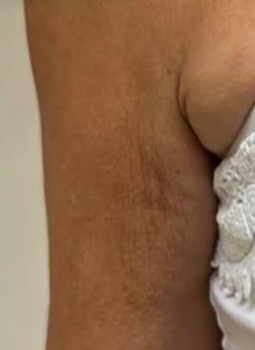 A close up of a person 's neck with a white shirt on.