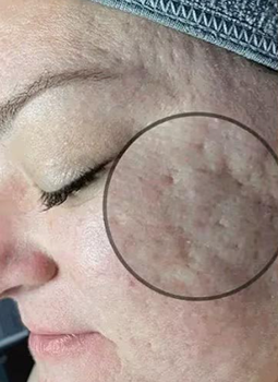 A close up of a woman 's face with a circle around it.