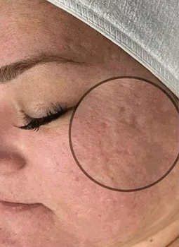 A close up of a woman 's face with a circle around it.