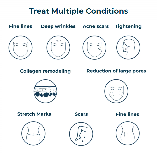 What microneedling treats.