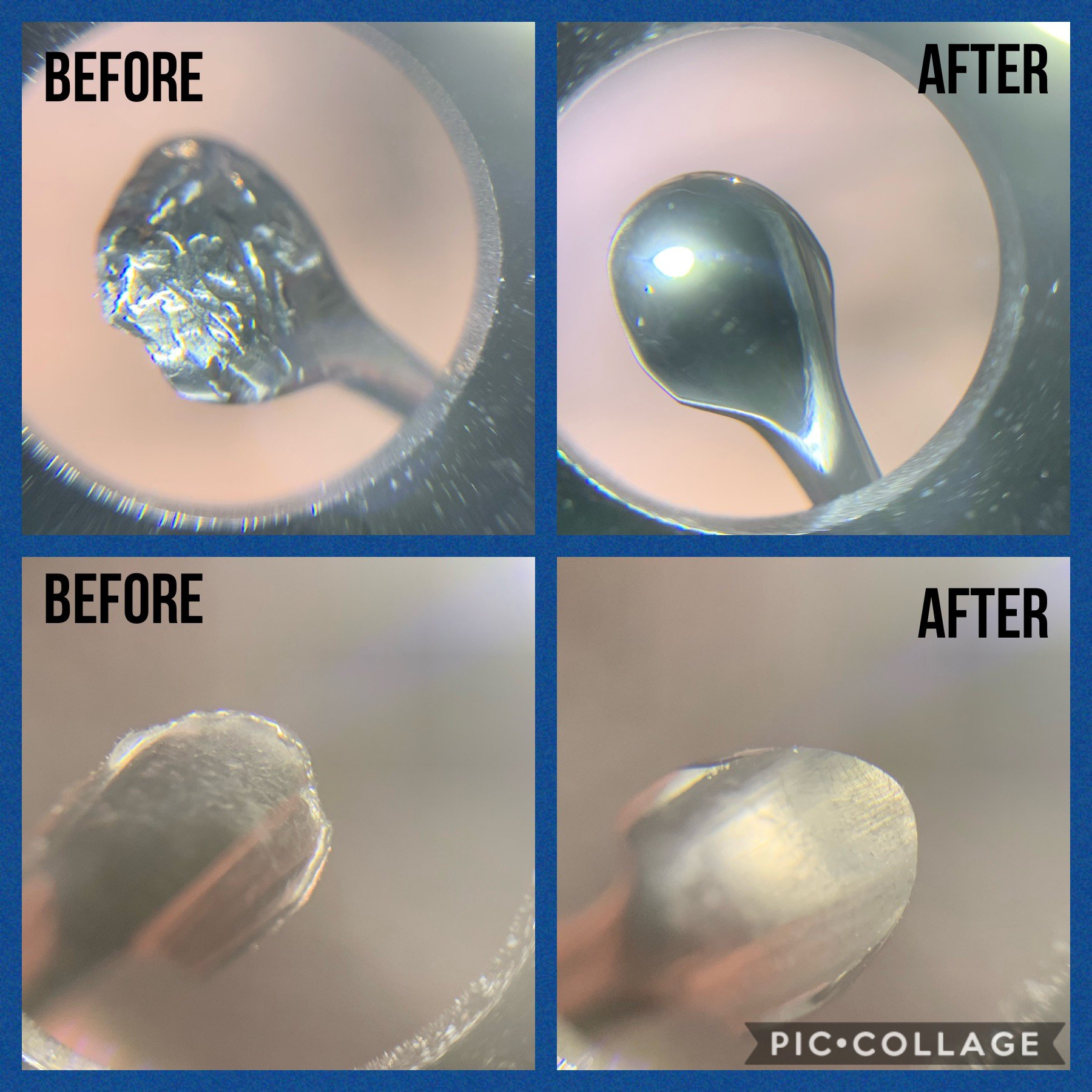 Surgical Instrument Before And After Photos