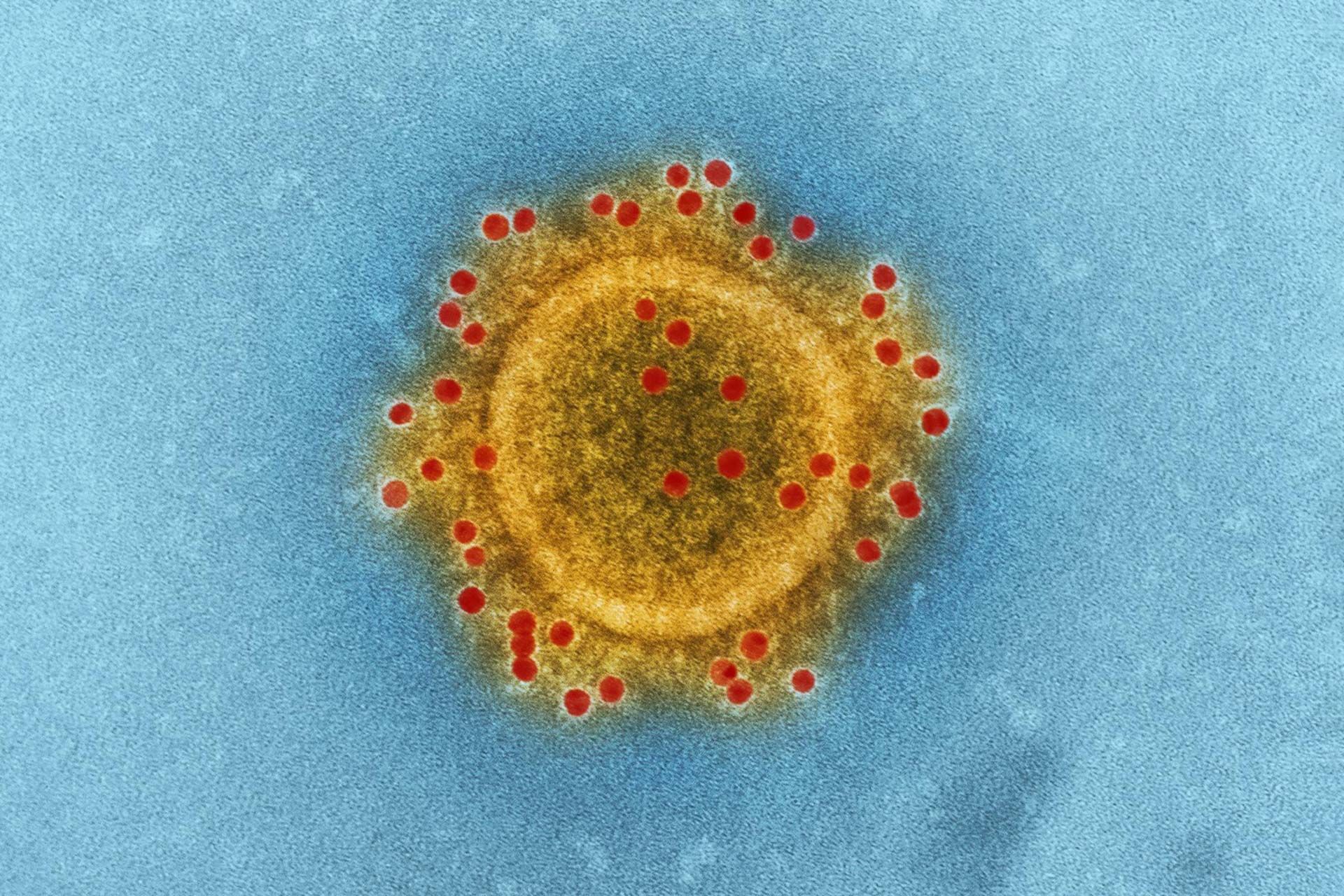 COVID-19, ein Virus, das alle in Atem hält