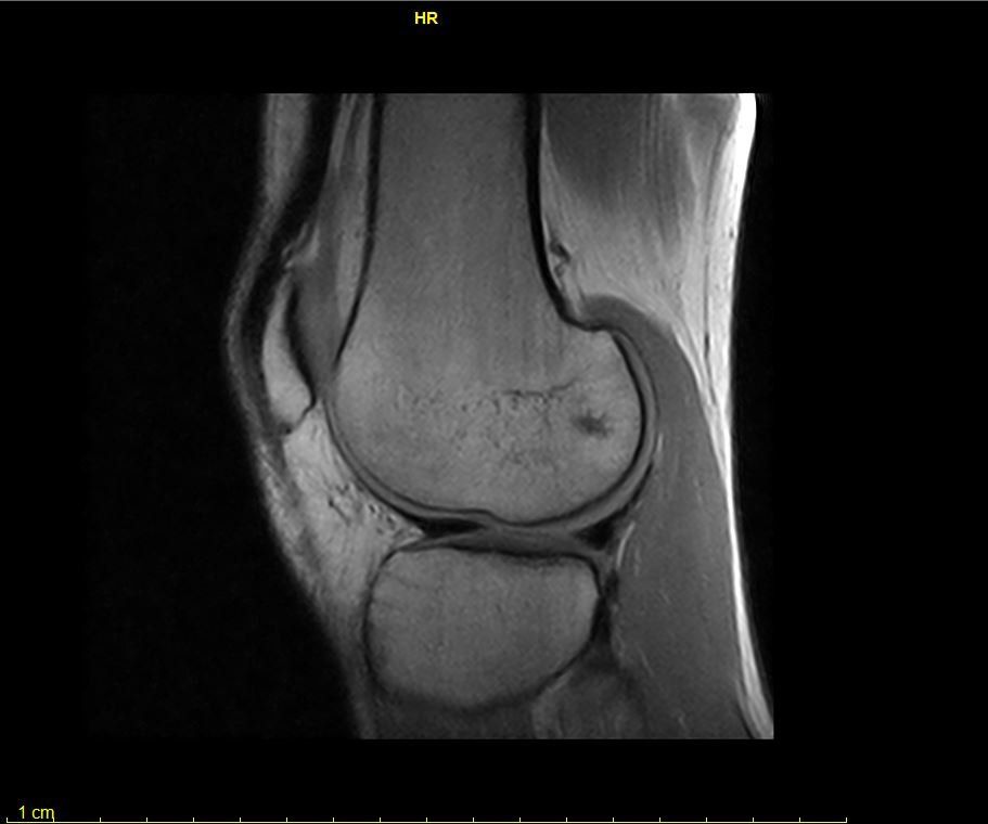 RISONANZA MAGNETICA