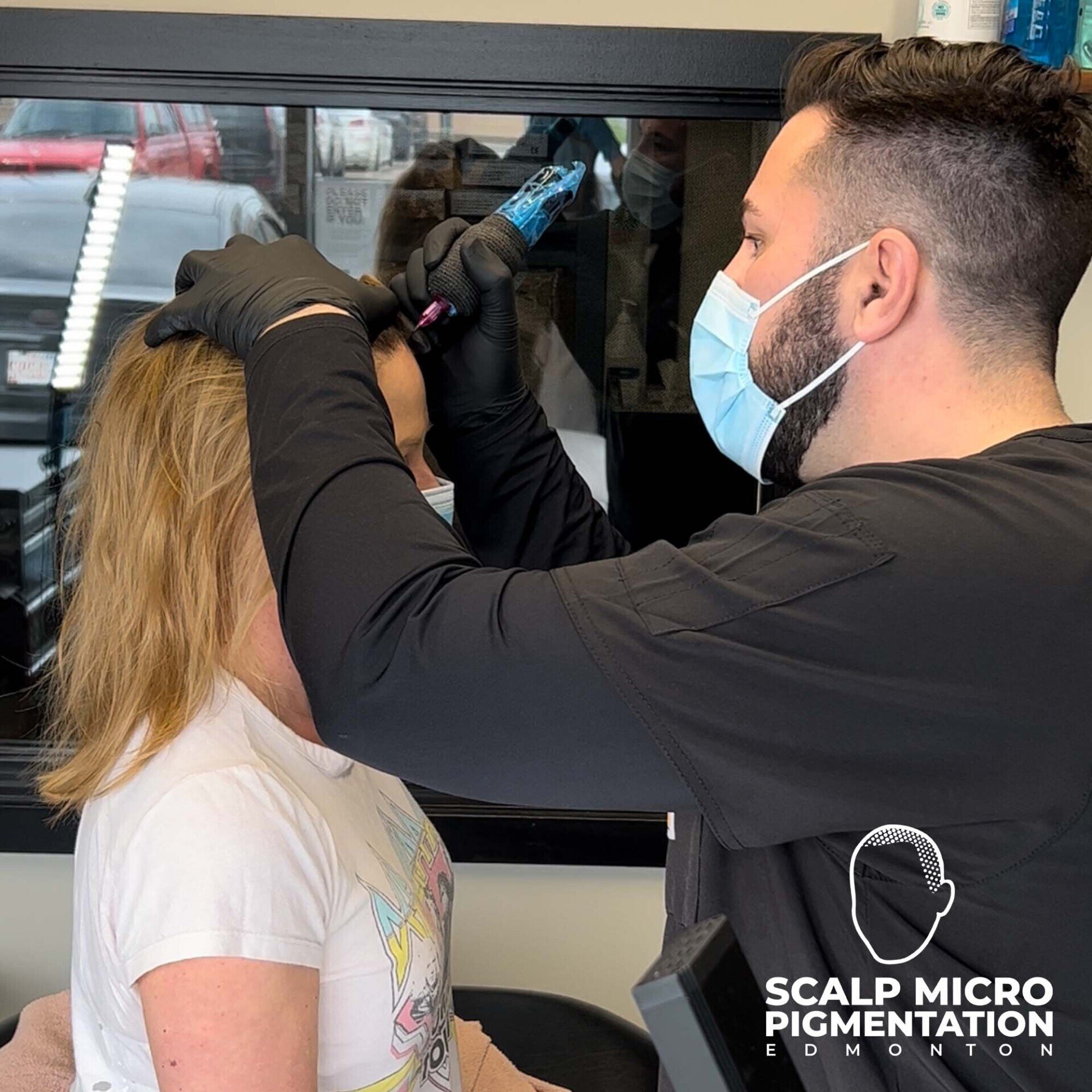 Unlocking Confidence why Women are Choose Scalp Micropigmentation