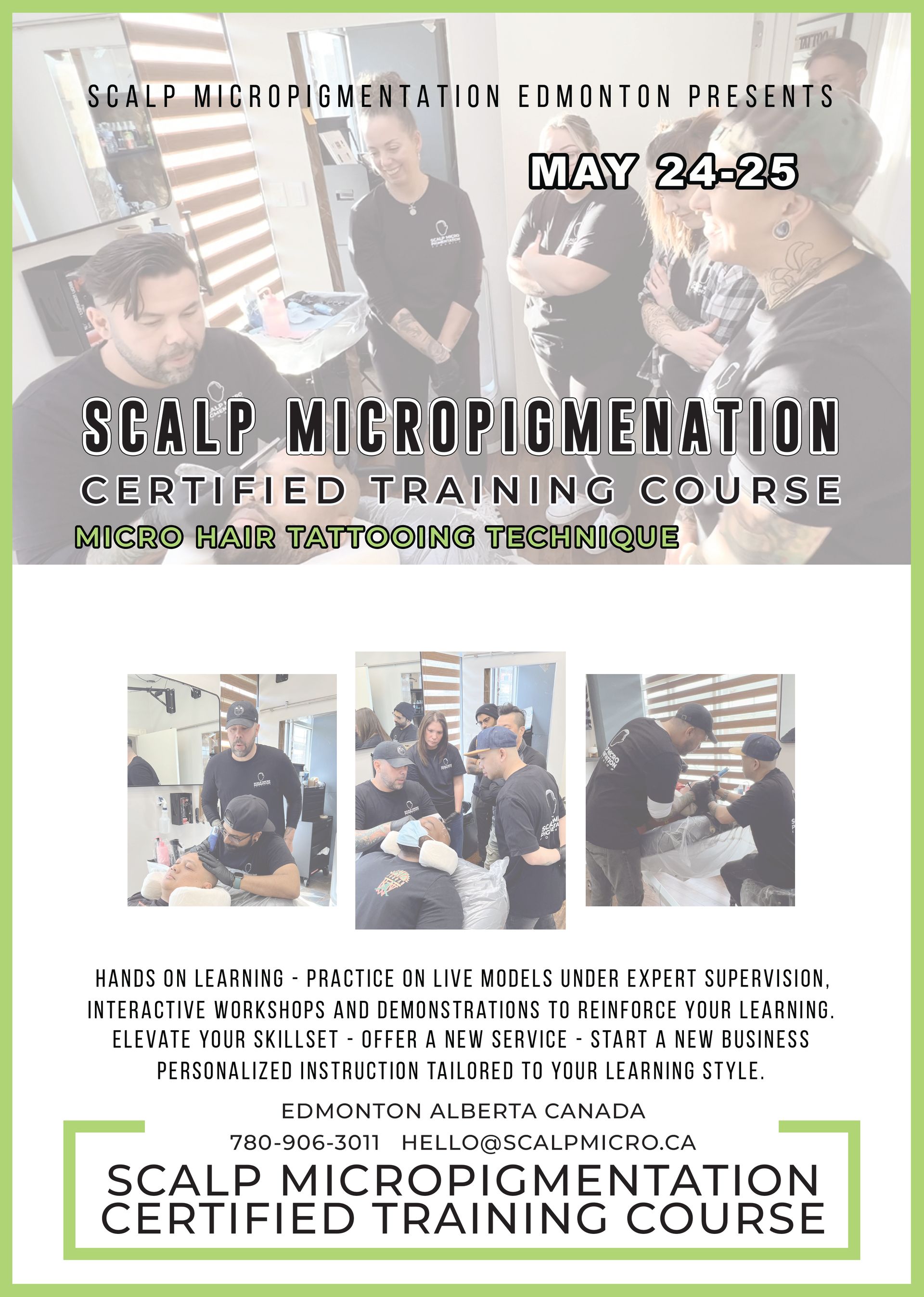 Scalp Micro Pigmentation Treatments SMP Edmonton