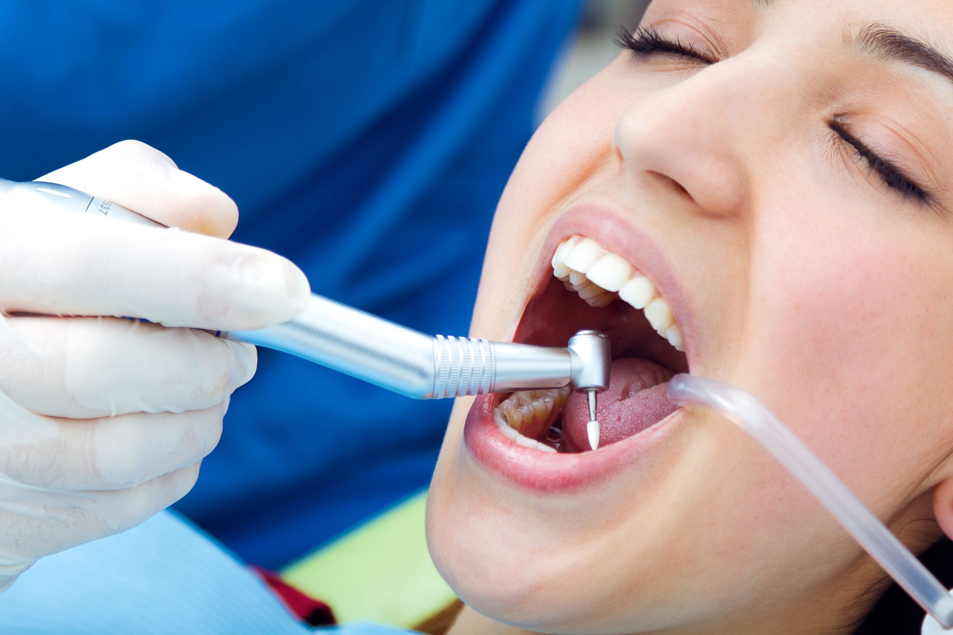 Una donna si sta facendo visitare i denti da un dentista - Arte Dentale Frosinone