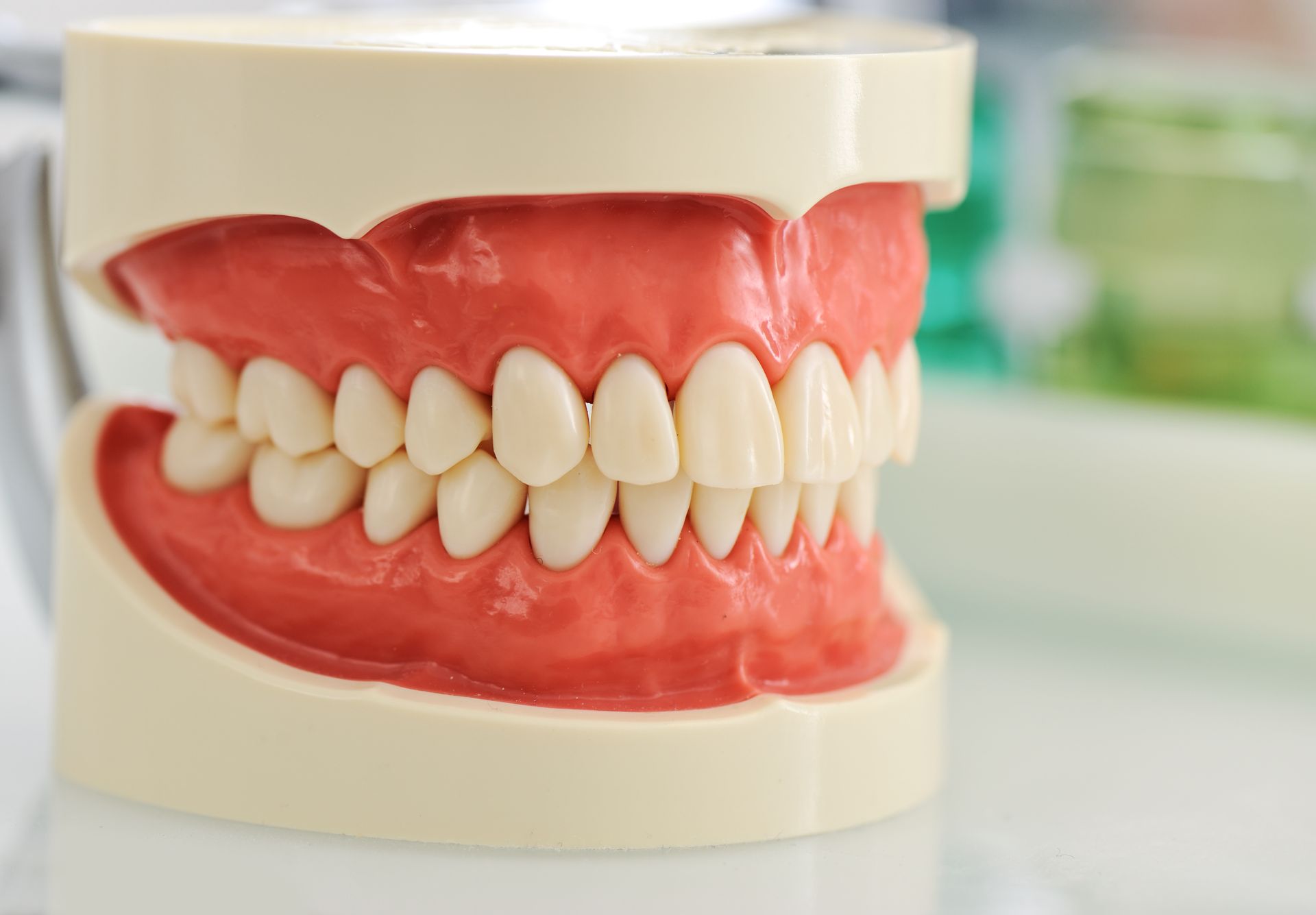 Un primo piano di un modello di denti su un tavolo - Arte Dentale Frosinone