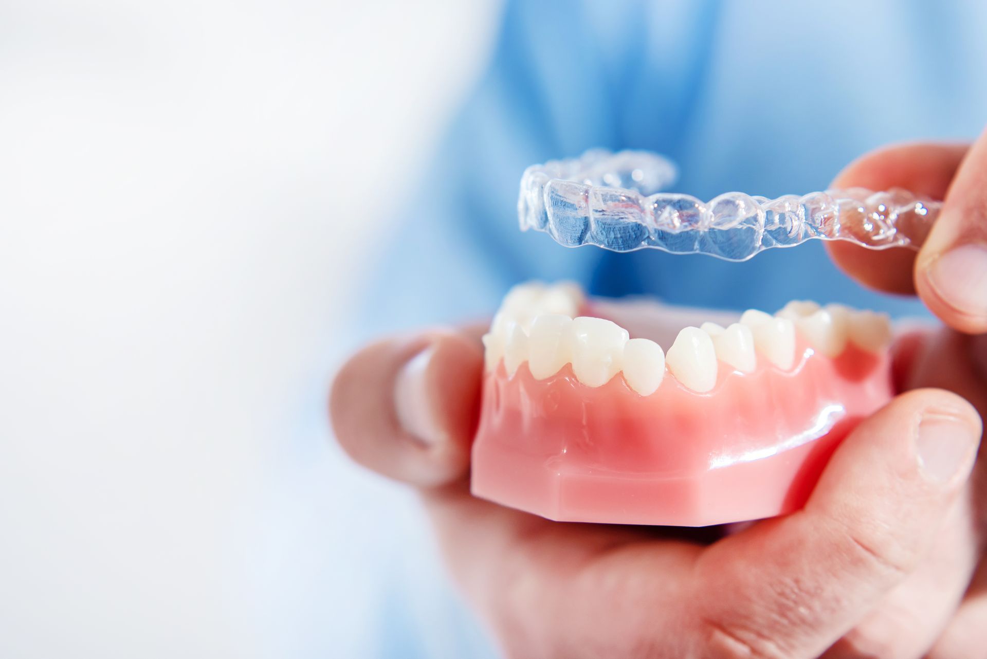 Una persona tiene in mano un modello di denti e un apparecchio trasparente - Arte Dentale Frosinone