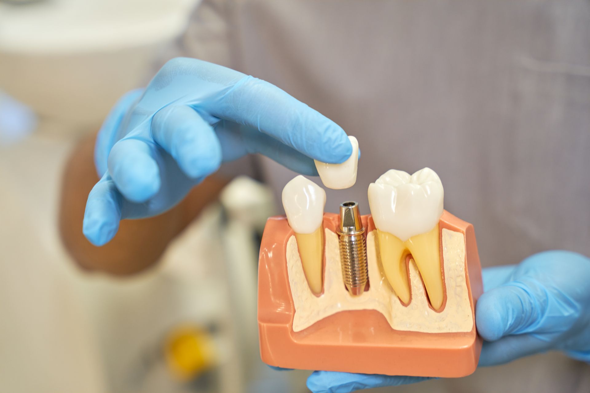 Trattamenti curativi 3 - Arte Dentale Frosinone