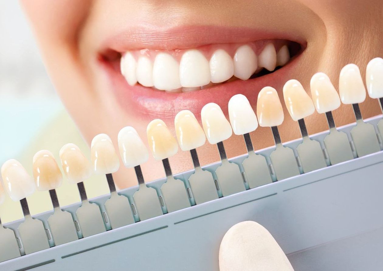 Trattamenti curativi - Arte Dentale Frosinone