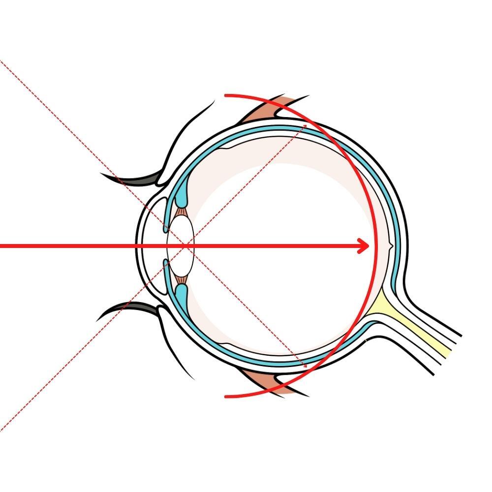 Ein Diagramm eines menschlichen Auges mit einem roten Pfeil, der auf die Netzhaut zeigt