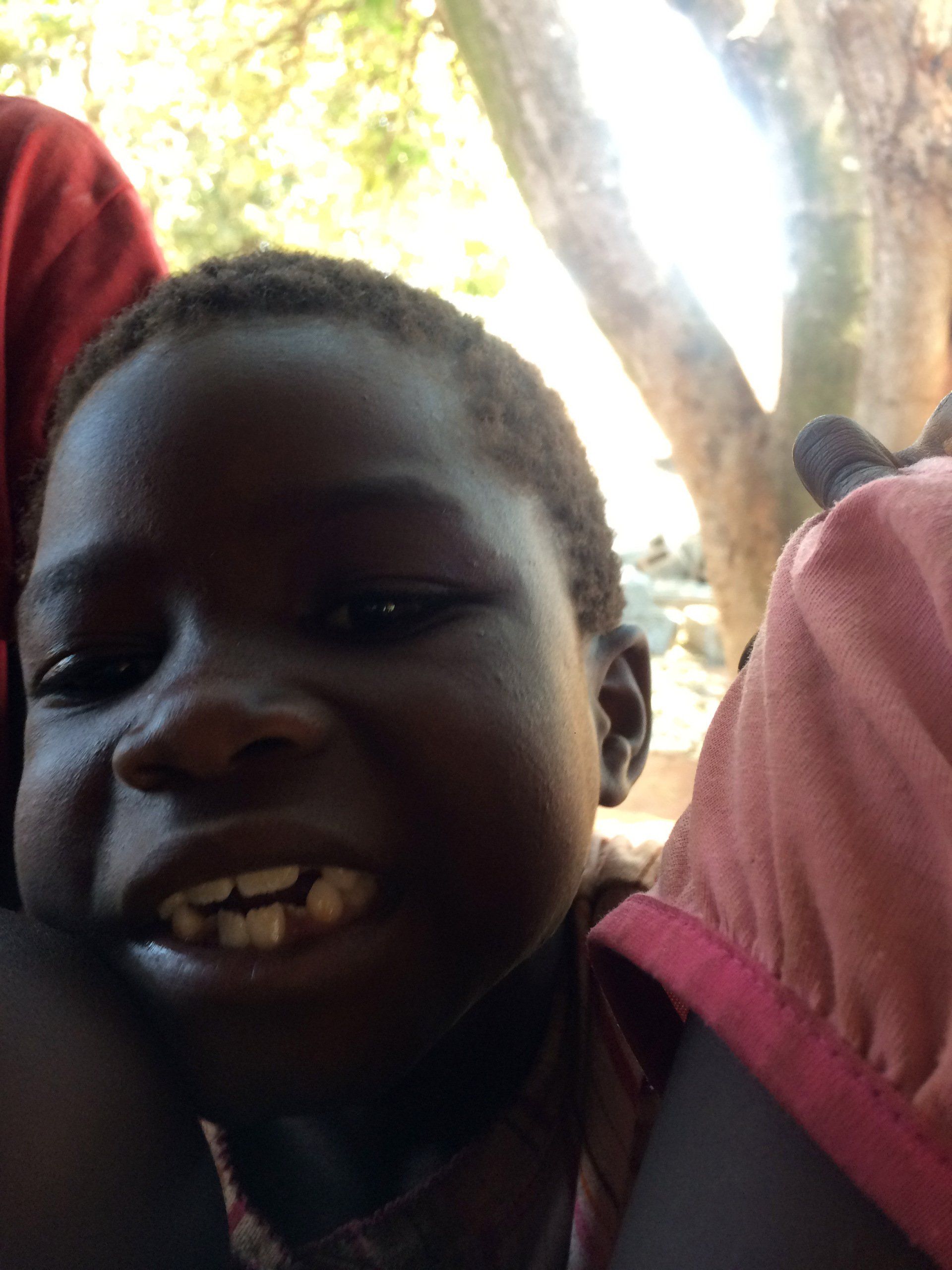 A close up of a child 's face with a tree in the background