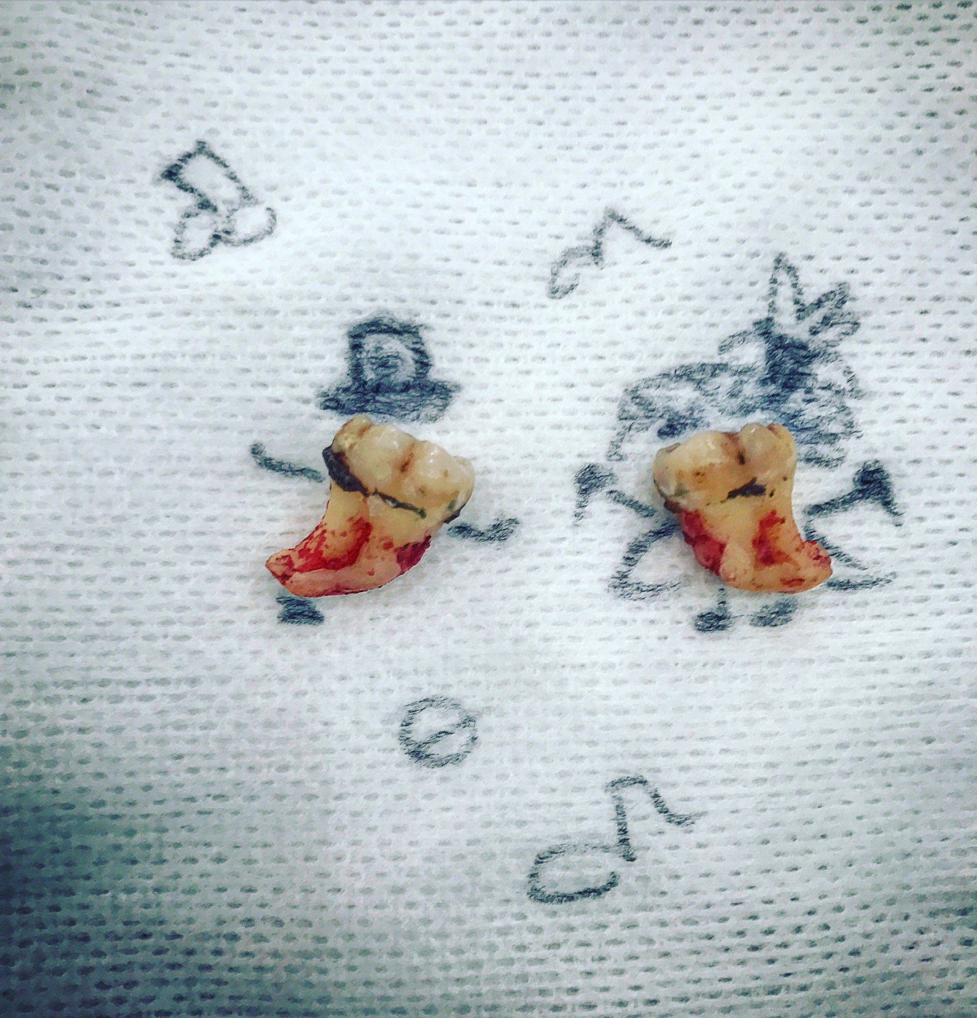 A pair of teeth are laying on a white cloth.