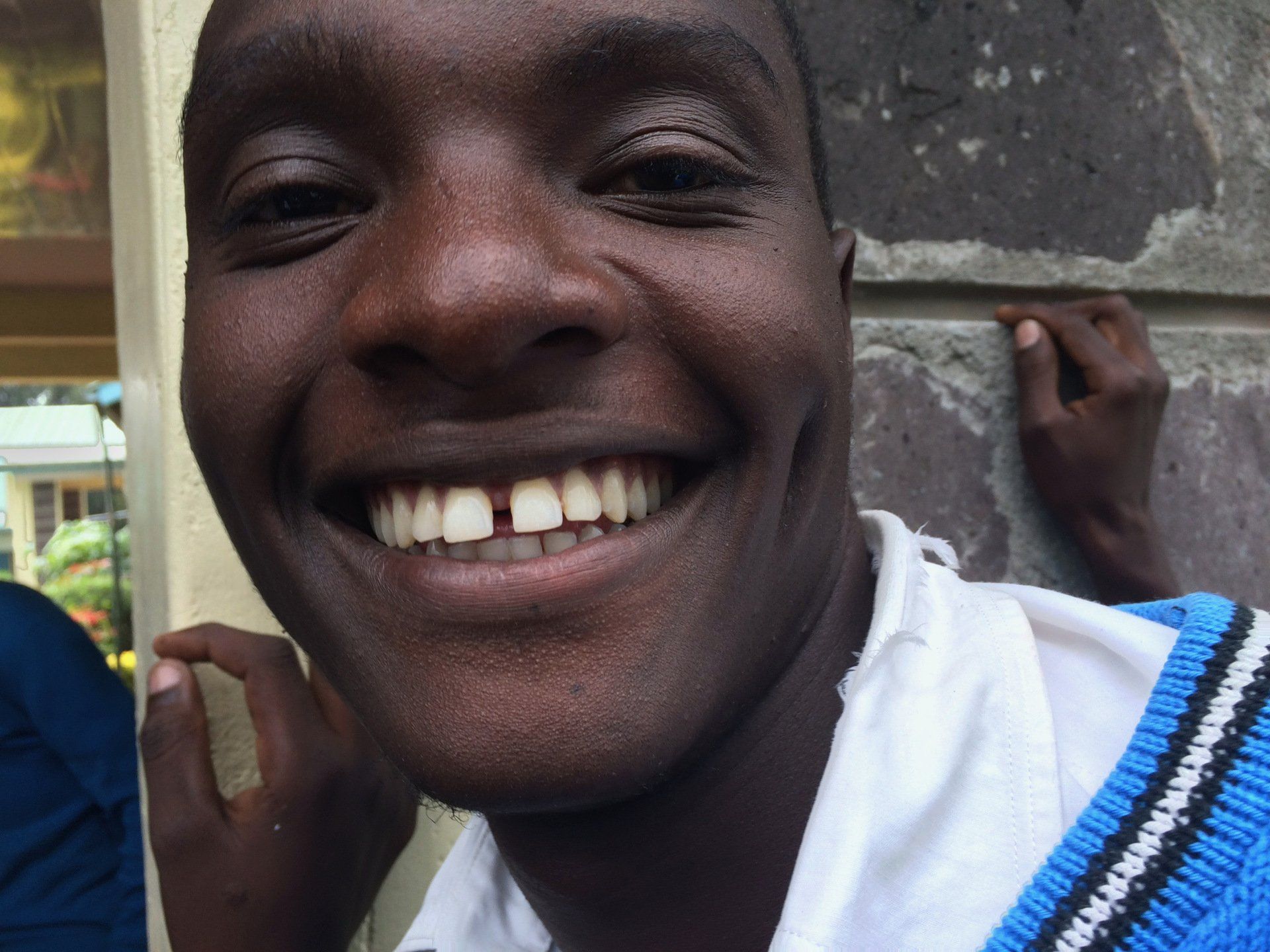 A man with missing teeth is smiling for the camera