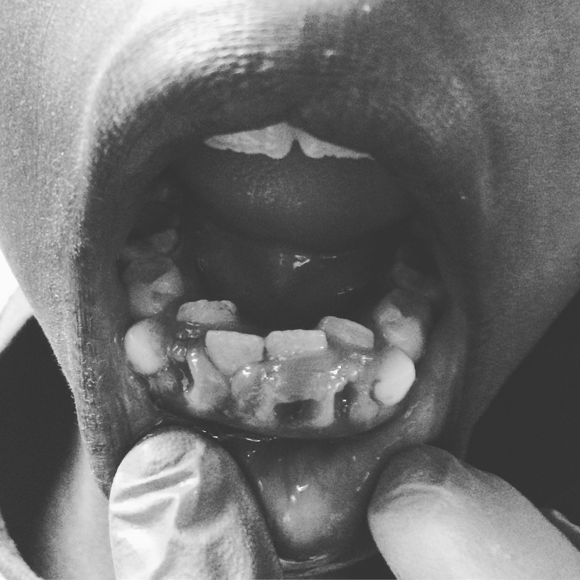 A close up of a person 's mouth showing their teeth