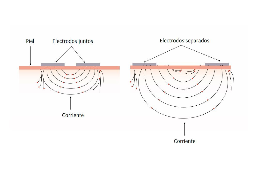 Figura humana con formas musculares etiquetadas: orbicular, largo, en abanico, plano y esfínter.