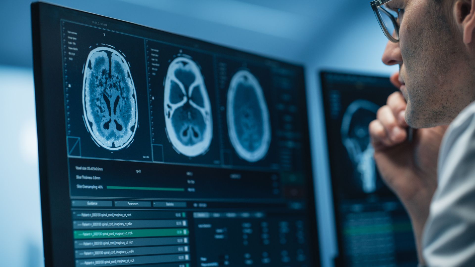 Doctor studying brain scans on a computer monitor in a dimly lit medical office