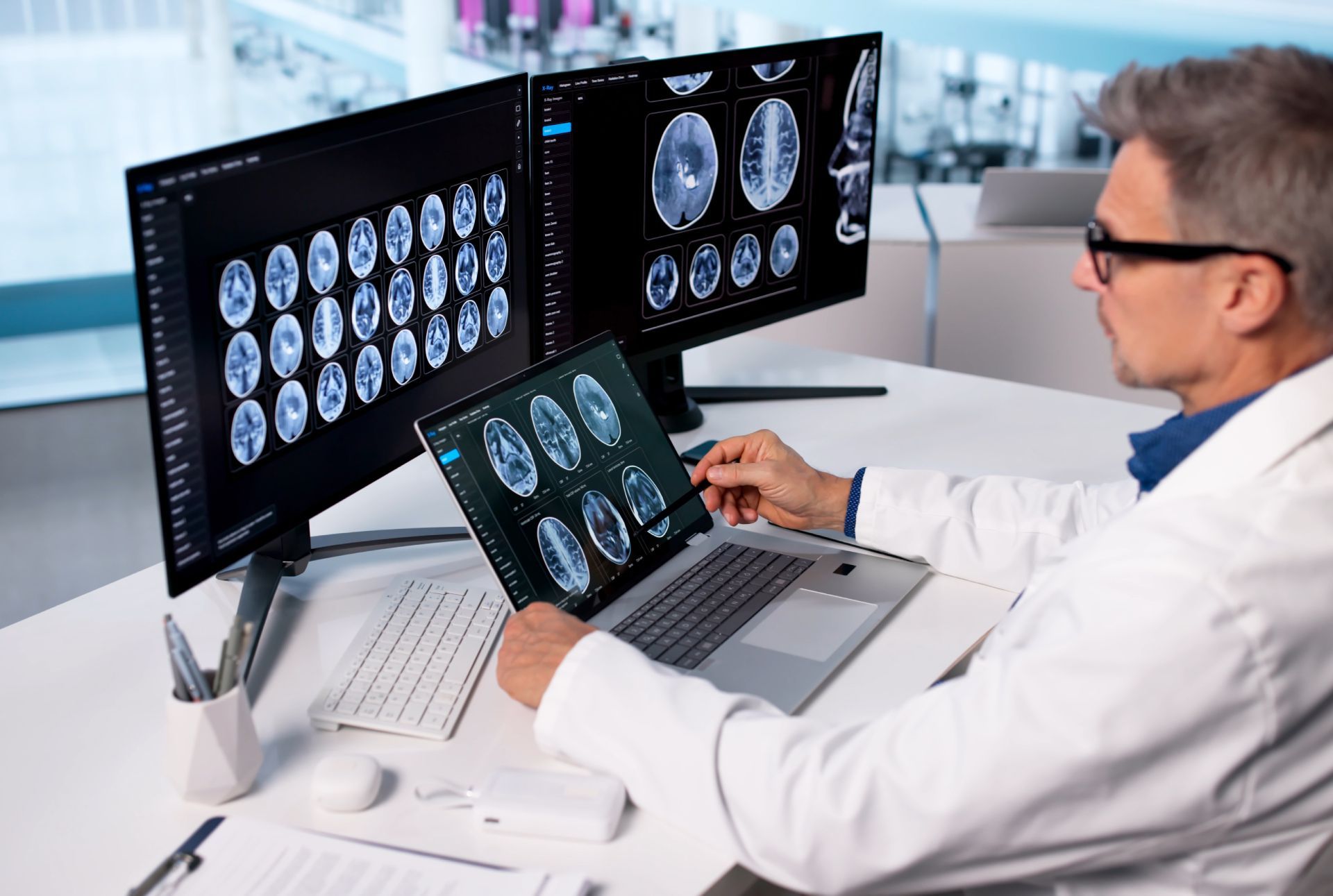 Doctor reviewing brain scans on multiple monitors in a bright clinic office