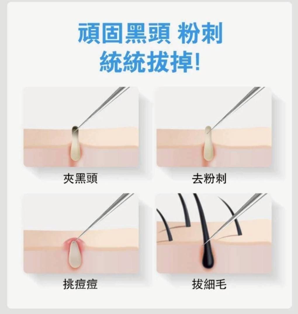不銹鋼粉刺清潔3件套組(清潔/除痘/美容工具)贈品：粉刺棒*