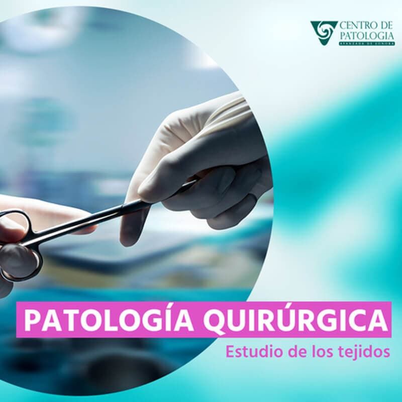 CENTRO DE PATOLOGÍA AVANZADA DE SONORA