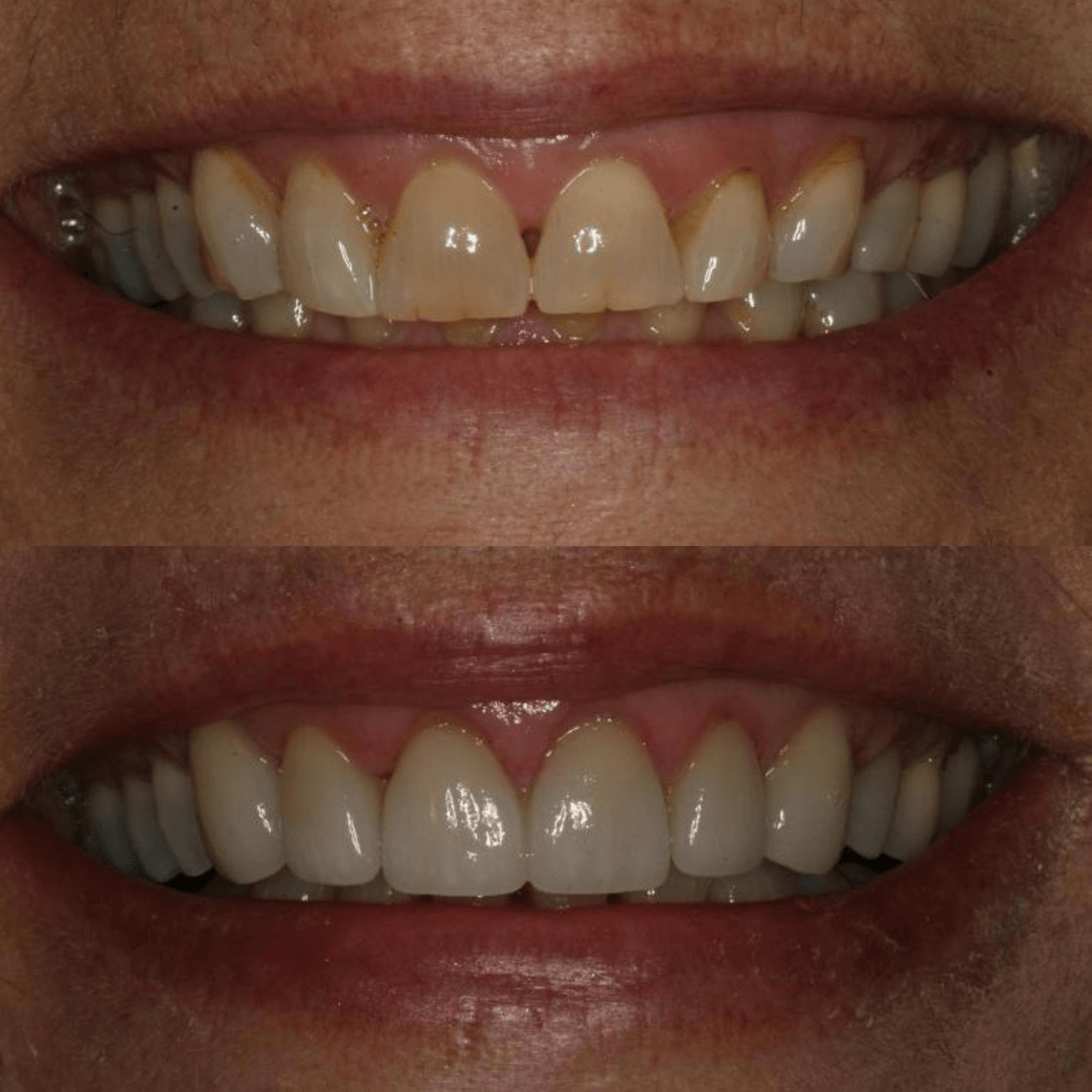 Dentist in Boise ID Atlantis Dental Care Dr. David Cantwell