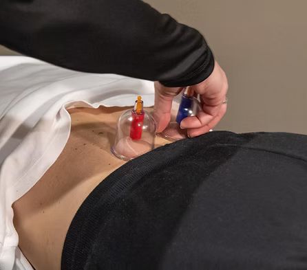 Cupping.