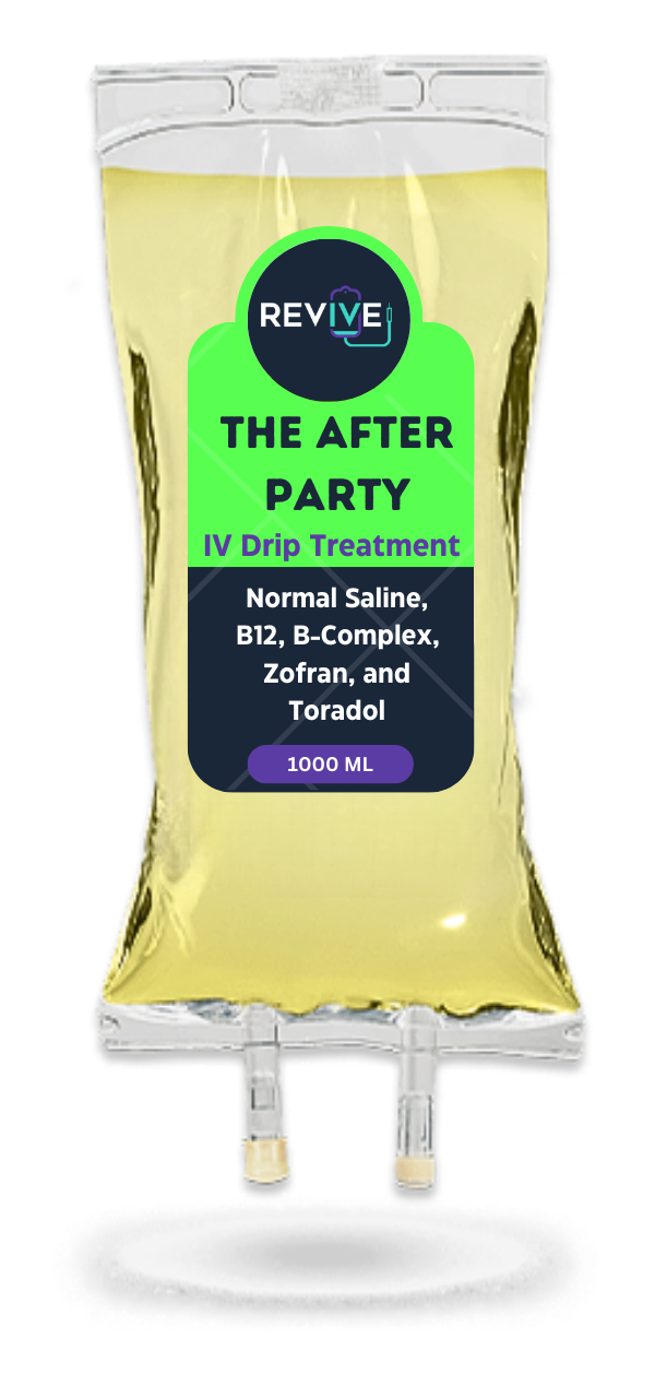 A bag of revive migraine minimizer iv drip treatment