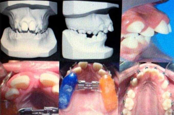 ODONTOKID - PROBLEMAS DENTALES