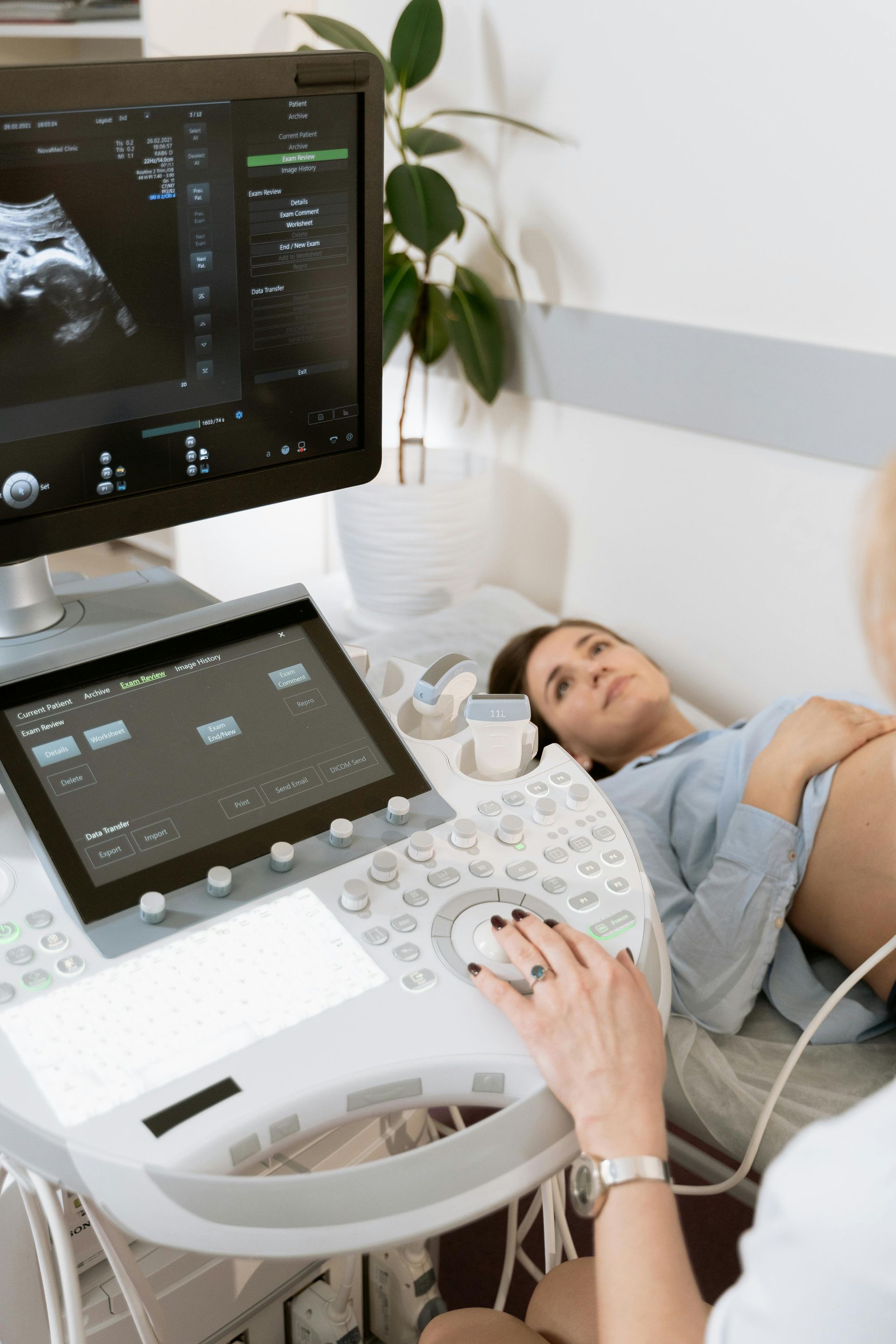 Una donna incinta si sottopone a un'ecografia da un medico.