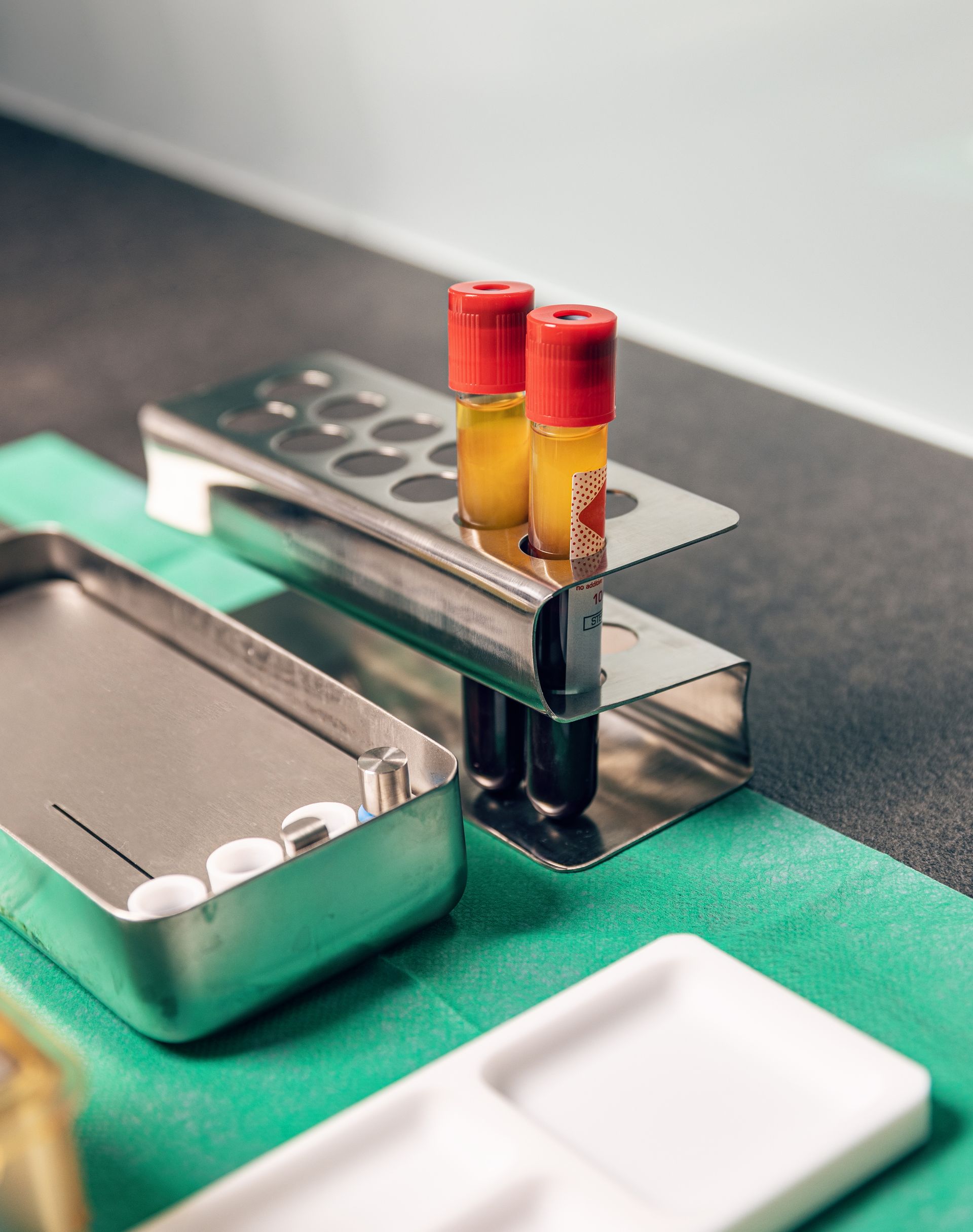 Medical lab setup with two blood collection tubes in a metal holder, alongside a tray with medical supplies on a green surface.
