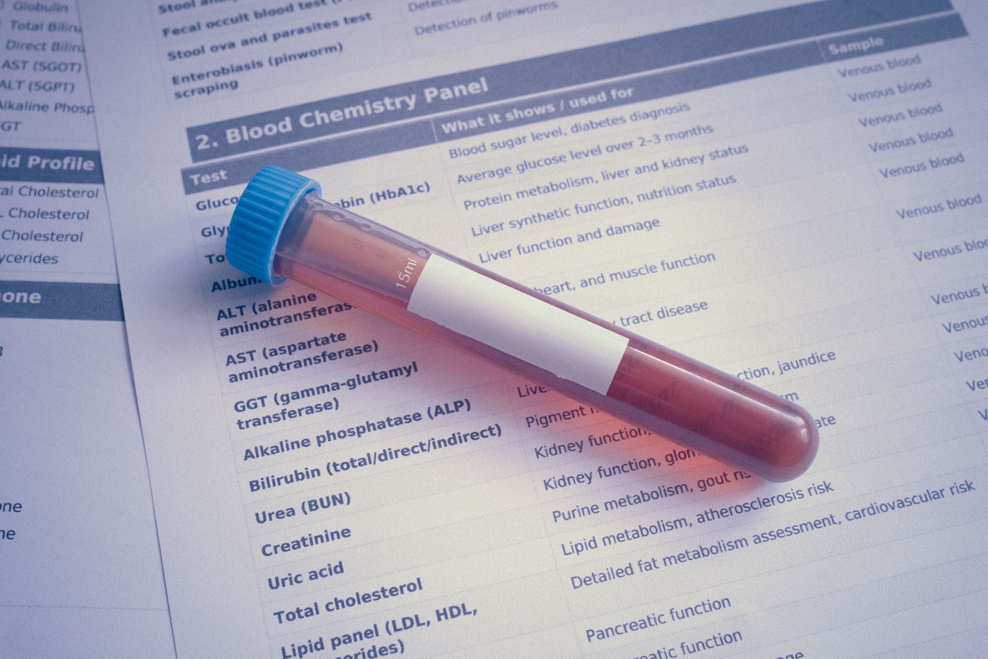 Blood test vial with red liquid on a lab results sheet