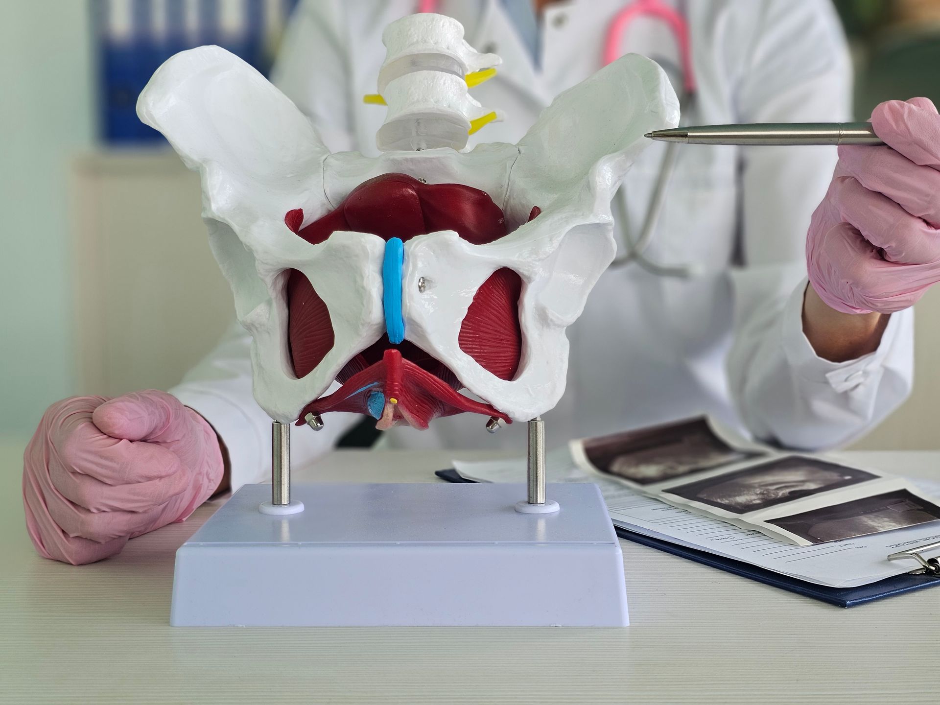 Doctor holds model of pelvic bone. Effective treatment of chronic pelvic pain concept. Doctor holds model of pelvic bone. Effective treatment of chronic pelvic pain concept.